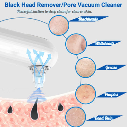 Mini Pore Vacuum — Blackhead Remover Kit