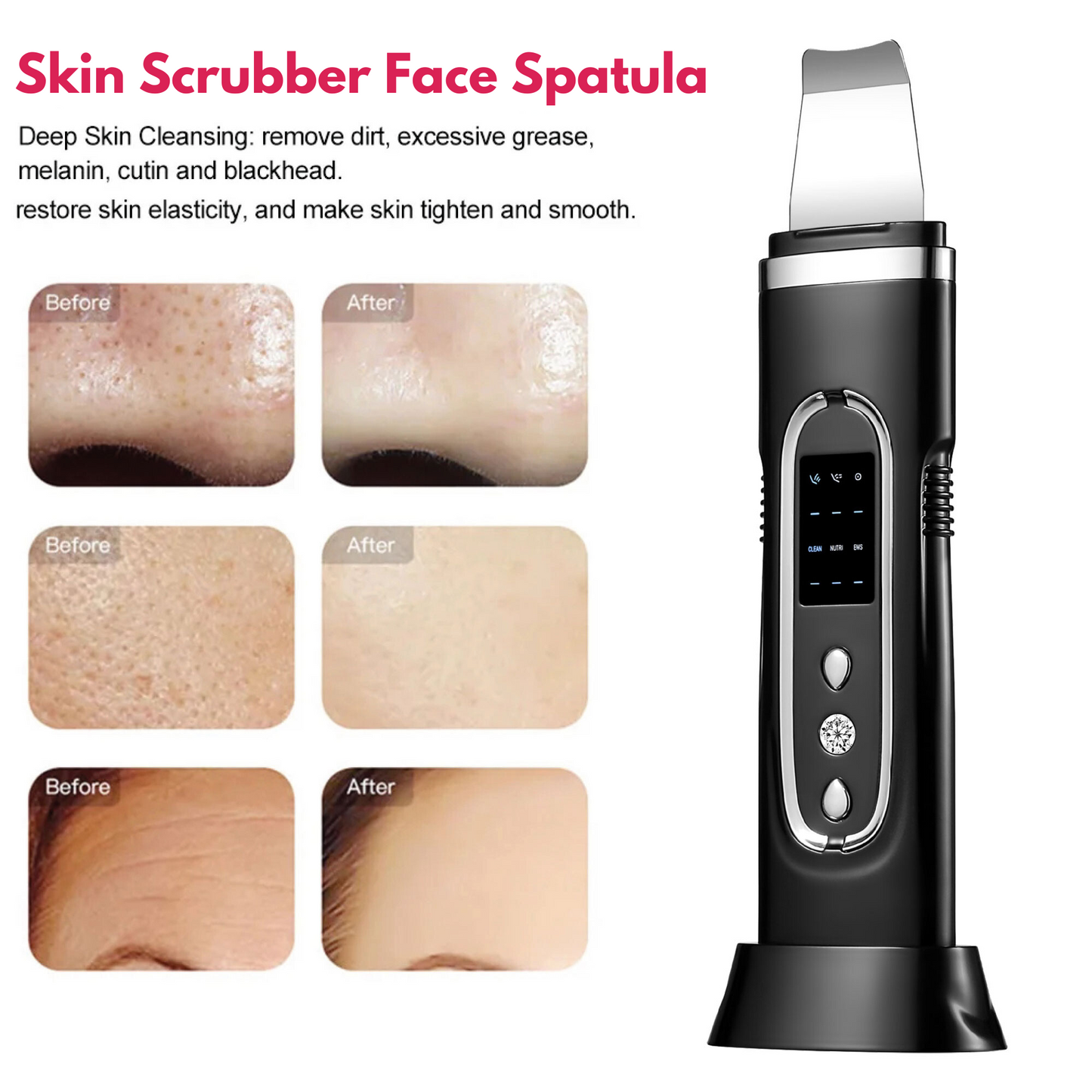 Ultrasonic Cleanser Skin Scrubber Face Spatula, Skin Spatula Pore Cleaner Blackhead Remover Tools for Facial Deep Cleansing, Skin Exfoliating Tool