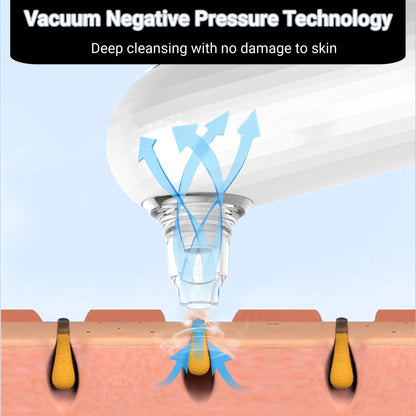 Mini Pore Vacuum — Blackhead Remover Kit