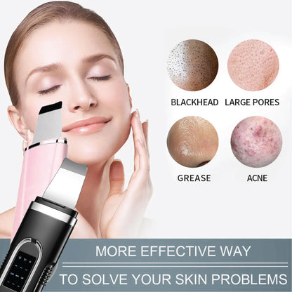 Ultrasonic Cleanser Skin Scrubber Face Spatula, Skin Spatula Pore Cleaner Blackhead Remover Tools for Facial Deep Cleansing, Skin Exfoliating Tool